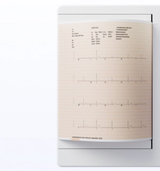 ekg-papier-210-x-250-mm
